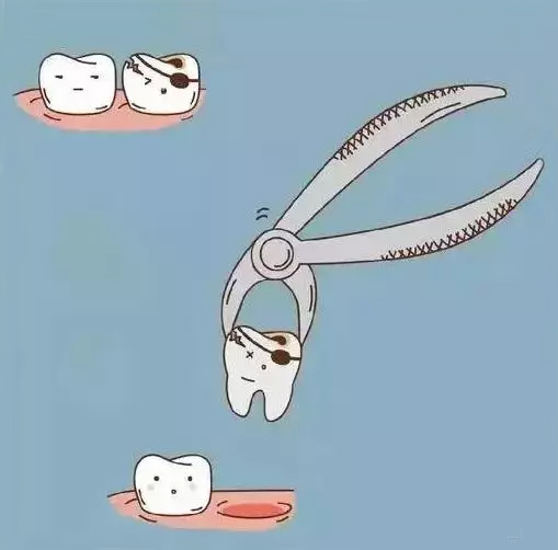 当智齿有蛀牙时